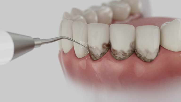 Reliable Dental Implants contractor in Helena Flats, MT by Smile Center Dentistry